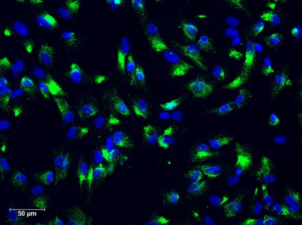 Human Astrocytes (HA)